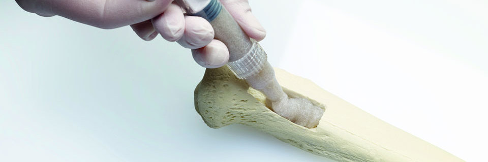 Bone Grafts and Substitutes Market